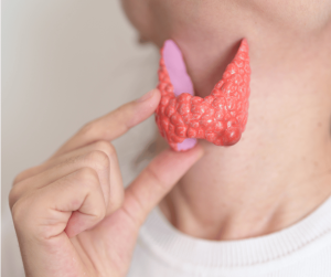 woman holding a plastic thyroid model by her neck
